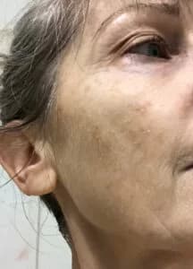 Day 7 after morning shower
