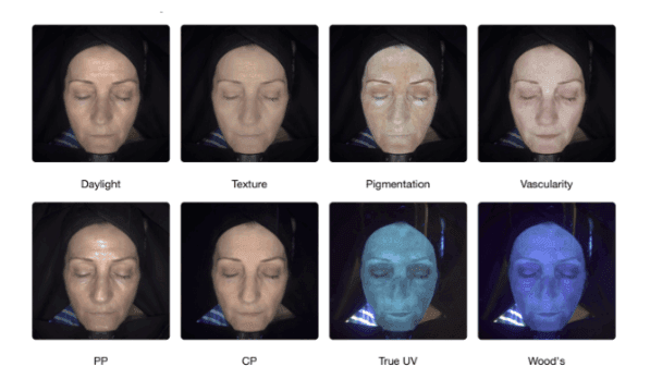 OBSERV facial scan results